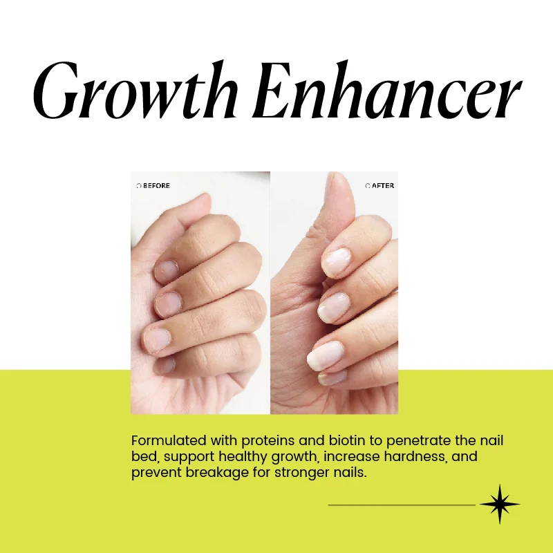 St Future Nail Treatment Growth Enhancer